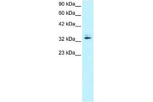WB Suggested Anti-NR2F6 Antibody   Titration: 0. (NR2F6 Antikörper  (N-Term))