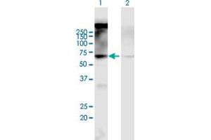 Western Blot analysis of CHRM2 expression in transfected 293T cell line by CHRM2 MaxPab polyclonal antibody. (Muscarinic Acetylcholine Receptor M2 Antikörper  (AA 1-466))