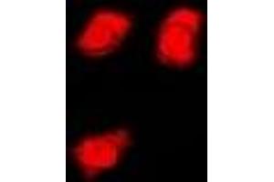 Immunofluorescent analysis of FMR1 staining in U2OS cells. (FMR1 Antikörper)