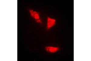 Immunofluorescent analysis of p53 (pS15) staining in PC12 cells. (p53 Antikörper  (N-Term, pSer15))