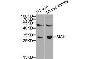 Western Blotting (WB) image for anti-E3 Ubiquitin-Protein Ligase SIAH1 (SIAH1) antibody (ABIN1874778) (SIAH1 Antikörper)