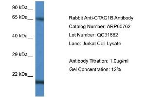 Western Blotting (WB) image for anti-Cancer/testis Antigen 1B (CTAG1B) (C-Term) antibody (ABIN786263) (CTAG1B Antikörper  (C-Term))
