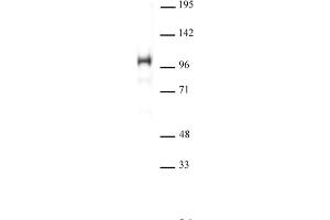 SATB1 antibody (pAb) tested by Western blot. (SATB1 Antikörper  (N-Term))