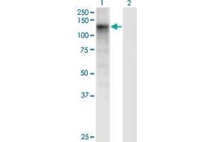 Western Blot analysis of DSE expression in transfected 293T cell line by DSE monoclonal antibody (M03), clone 6D4. (DSE Antikörper  (AA 574-673))