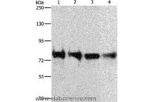 Western blot analysis of 293T, hela, Jurkat and Lovo cell, using CDH6 Polyclonal Antibody at dilution of 1:300 (CDH6 Antikörper)