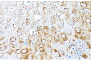 Immunohistochemistry (Paraffin-embedded Sections) (IHC (p)) image for anti-Ribosomal Protein L7 (RPL7) antibody (ABIN7261876)