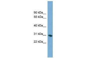 FCN1 antibody used at 0. (FCN1 Antikörper  (Middle Region))