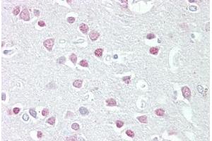 Anti-MC5 Receptor antibody IHC staining of human brain, cortex. (MC5 Receptor Antikörper  (AA 24-35))