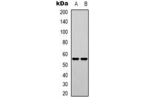 Western blot analysis of DNA Polymerase mu expression in K562 (A), Jurkat (B) whole cell lysates. (POLM Antikörper)