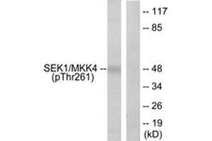 Western blot analysis of extracts from 293 cells treated with UV 15', using SEK1/MKK4 (Phospho-Thr261) Antibody. (MAP2K4 Antikörper  (pThr261))