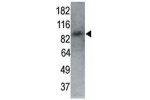 MARK1 antibody used in western blot to detect MARK1 in P7 mouse whole brain lysate (60 ug) at 1:250.