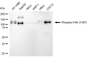Western blotting analysis using phospho-FAK (Y397) antibody (ABIN7800061).