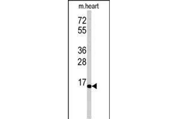 UBE2G1 抗体  (N-Term)
