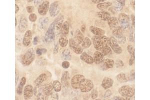 Immunohistochemistry (IHC) image for anti-Cullin 2 (CUL2) (AA 150-200) antibody (ABIN7448503) (Cullin 2 Antikörper  (AA 150-200))
