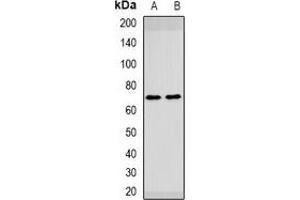 Western blot analysis of HAI-1 expression in mouse liver (A), rat brain (B) whole cell lysates. (SPINT1 Antikörper)