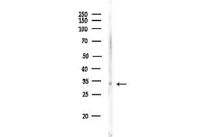 Western blot analysis of lysates from Rat lung, using Phospho-RPS6 (Ser235) Antibody at 1/1000 dilution.