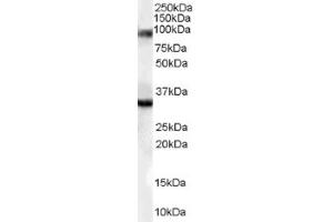 Image no. 1 for anti-LIM Domain Binding 3 (LDB3) (Internal Region) antibody (ABIN374603) (LIM Domain Binding 3 Protein Antikörper  (Internal Region))
