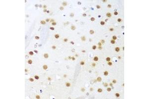 Immunohistochemistry of paraffin-embedded mouse brain using UNG antibody (ABIN6133476, ABIN6149934, ABIN6149936 and ABIN6216305) at dilution of 1:100 (40x lens). (UNG Antikörper  (AA 1-313))