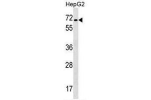 CACNB1 Antibody (C-term) western blot analysis in HepG2 cell line lysates (35µg/lane). (CACNB1 Antikörper  (C-Term))