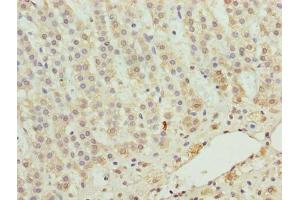 Immunohistochemistry of paraffin-embedded human adrenal gland tissue using ABIN7176171 at dilution of 1:100 (ZNF226 Antikörper  (AA 1-94))