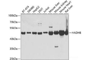 Western blot analysis of extracts of various cell lines using HADHB Polyclonal Antibody at dilution of 1:1000. (HADHB Antikörper)
