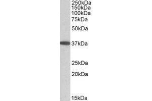 Western Blotting (WB) image for anti-Monoacylglycerol O-Acyltransferase 2 (MOGAT2) (Internal Region) antibody (ABIN2464724) (MOGAT2 Antikörper  (Internal Region))