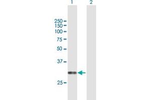 Western Blotting (WB) image for anti-Calcium Channel, Voltage-Dependent, gamma Subunit 6 (CACNG6) (AA 1-260) antibody (ABIN949557)