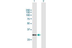 Western Blot analysis of CACNG6 expression in transfected 293T cell line by CACNG6 MaxPab polyclonal antibody. (CACNG6 Antikörper  (AA 1-260))