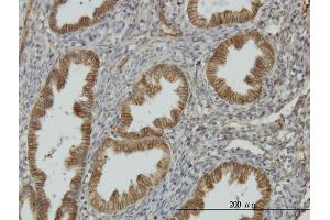 Immunoperoxidase of monoclonal antibody to NDRG1 on formalin-fixed paraffin-embedded human endometrium. (NDRG1 Antikörper  (AA 1-394))