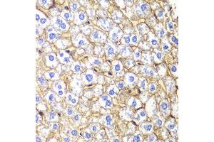 Immunohistochemistry of paraffin-embedded mouse liver using CDH2 antibody at dilution of 1:100 (400x lens). (N-Cadherin Antikörper)