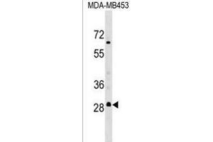 RH3 Antibody (C-term) (ABIN1536881 and ABIN2849415) western blot analysis in MDA-M cell line lysates (35 μg/lane). (MARCH3 Antikörper  (C-Term))
