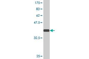 Western Blot detection against Immunogen (36. (ARHGEF11 Antikörper  (AA 651-750))