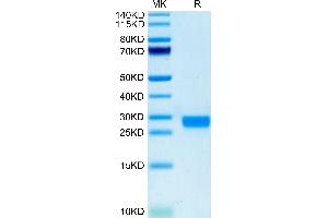 Biotinylated Mouse IL-2 on Tris-Bis PAGE under reduced condition. (IL-2 Protein (AA 21-169) (His-Avi Tag,Biotin))