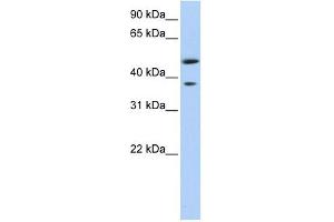 MAGEA3 antibody used at 1 ug/ml to detect target protein. (MAGEA3 Antikörper  (Middle Region))