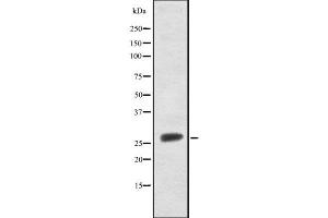 Western blot analysis FRAT1 using Jurkat whole cell lysates (FRAT1 Antikörper  (C-Term))