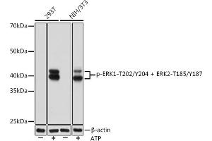 Western blot analysis of extracts of various cell lines, using Phospho-ERK1-T202/Y204 + ERK2-T185/Y187 Rabbit mAb (ABIN7268623) at 1:1000 dilution. (ERK1 Antikörper  (pThr185, pThr202, pThr204, pTyr187))