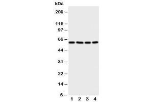Western blot testing of RIP2 antibody and Lane 1:  A549 (RIP2 Antikörper  (C-Term))