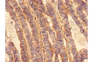 Immunohistochemistry (IHC) image for anti-Vacuolar Protein Sorting 26 Homolog B (VPS26B) (AA 1-336) antibody (ABIN7175296)