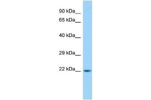 WB Suggested Anti-ARL15 Antibody Titration: 1. (ARL15 Antikörper  (C-Term))
