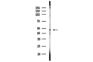 anti-Inositol Polyphosphate Multikinase (IPMK) (Internal Region) antibody