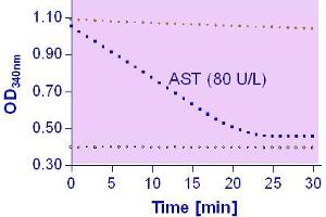 Biochemical Assay (BCA) image for Aspartate Transaminase Assay Kit (ABIN1000292) (Aspartate Transaminase Assay Kit)