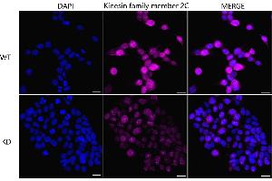 anti-Kinesin Family Member 2C (KIF2C) antibody