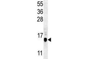 LC3II antibody western blot analysis in mouse cerebellum tissue lysate