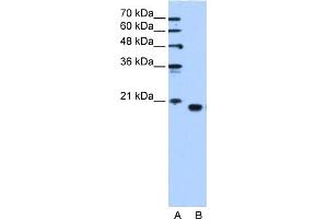PEBP1 antibody used at 1. (PEBP1 Antikörper  (C-Term))
