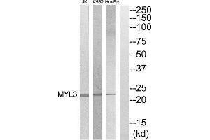 Western Blotting (WB) image for anti-Myosin, Light Chain 3 (MYL3) (Internal Region) antibody (ABIN1852580) (MYL3/CMLC1 Antikörper  (Internal Region))