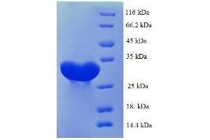 Protein expressed in E. (CA1 Protein (AA 2-261, full length) (His tag))