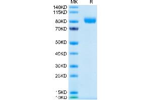 Human GM-CSF R alpha on Tris-Bis PAGE under reduced condition. (CSF2RA Protein (AA 23-320) (Fc Tag))