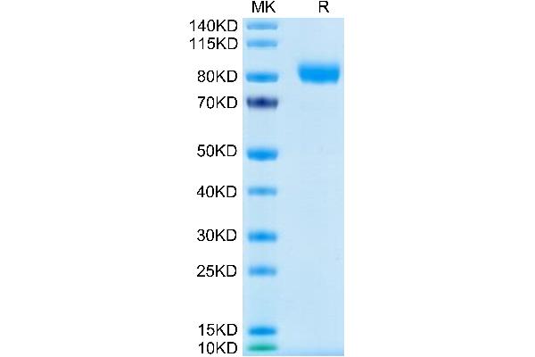 CSF2RA Protein (AA 23-320) (Fc Tag)