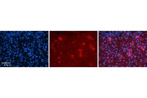 Rabbit Anti-YBX1 Antibody Catalog Number: ARP50946_P050 Formalin Fixed Paraffin Embedded Tissue: Human Liver Tissue Observed Staining: Cytoplasm in Kupffer cells in sinusoids Primary Antibody Concentration: 1:100 Other Working Concentrations: 1:600 Secondary Antibody: Donkey anti-Rabbit-Cy3 Secondary Antibody Concentration: 1:200 Magnification: 20X Exposure Time: 0. (YBX1 Antikörper  (C-Term))