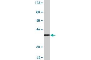 Western Blot detection against Immunogen (36. (CPA4 Antikörper  (AA 260-361))